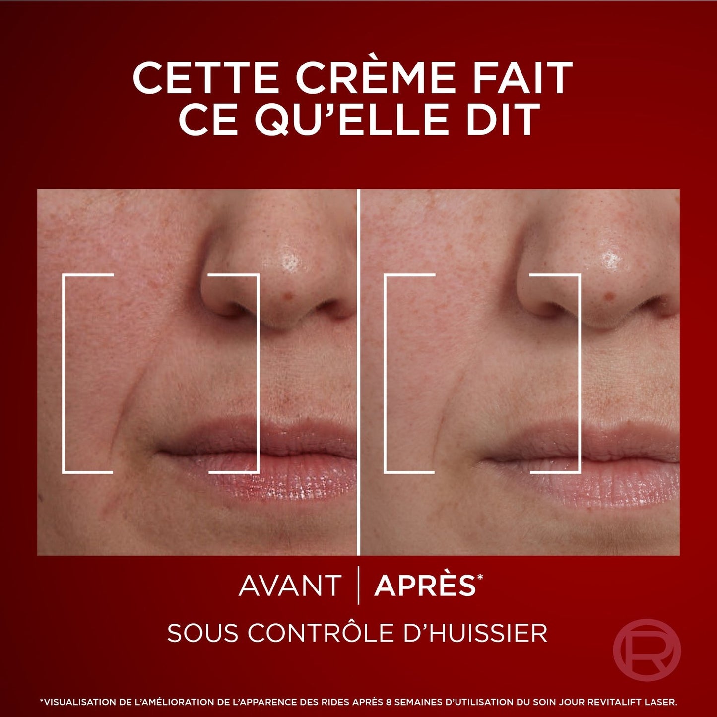 L'OREAL PARIS Revitalift Laser Anti-Wrinkle Day Face Cream