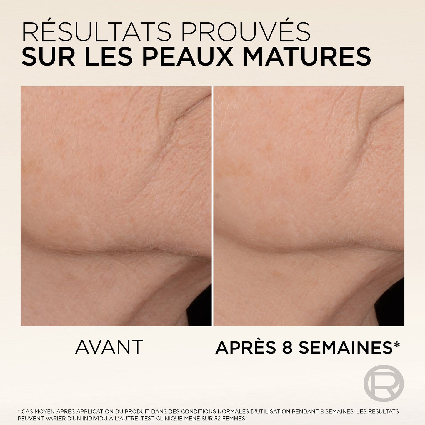 Sérum Anti-Relâchement - Age Perfect Micro-Peptide de Collagène L'OREAL PARIS