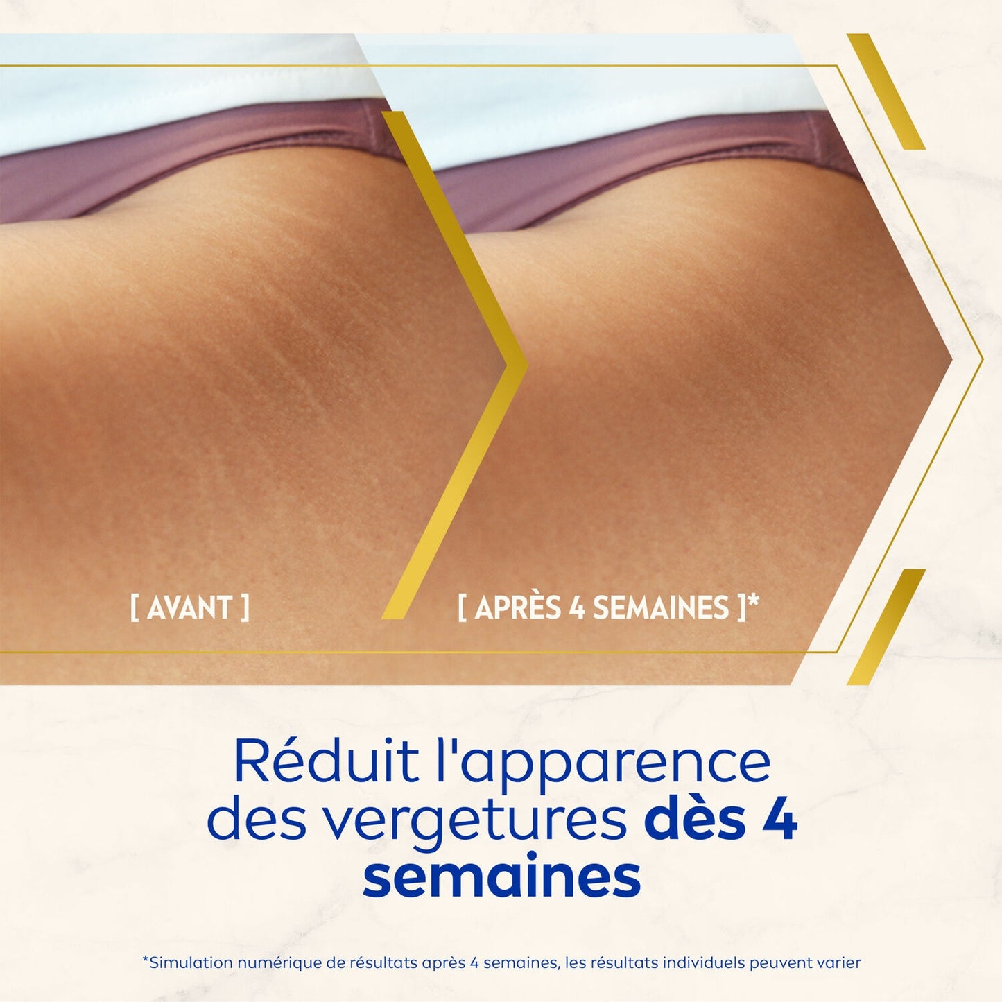 NIVEA Luminous Anti-Dehnungsstreifen-Öl