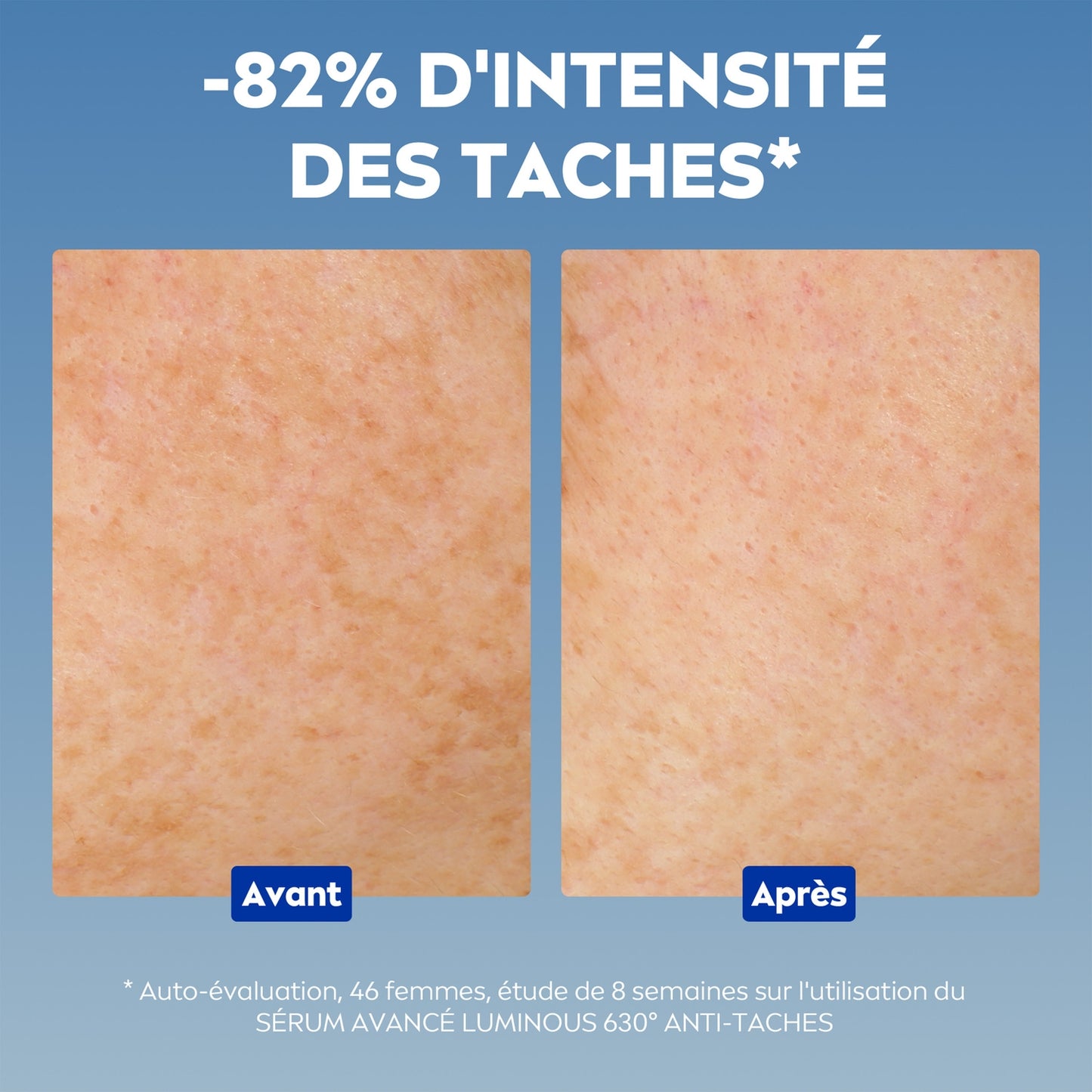NIVEA Luminous 63 Anti-Flecken- und Pickel-Tagescreme