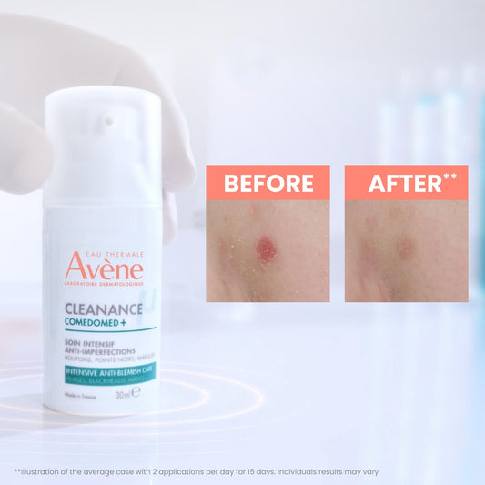 Gel Crème Soin Intensif Anti-Imperfections Peaux Grasses Tendance Acnéique Comedomed+ EAU THERMALE AVENE 