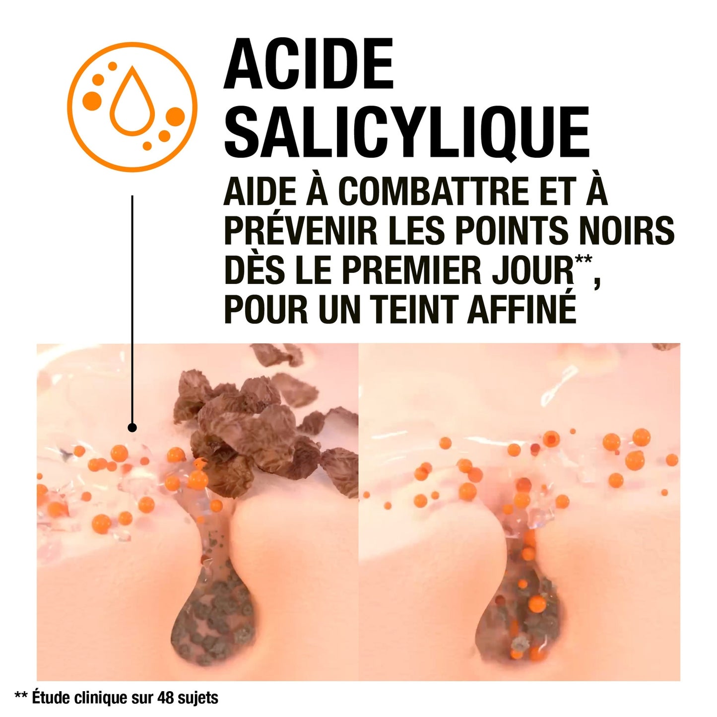Soin Visage Anti Points Noirs Lotion Désincrustation à l'Acide Salicyque NEUTROGENA