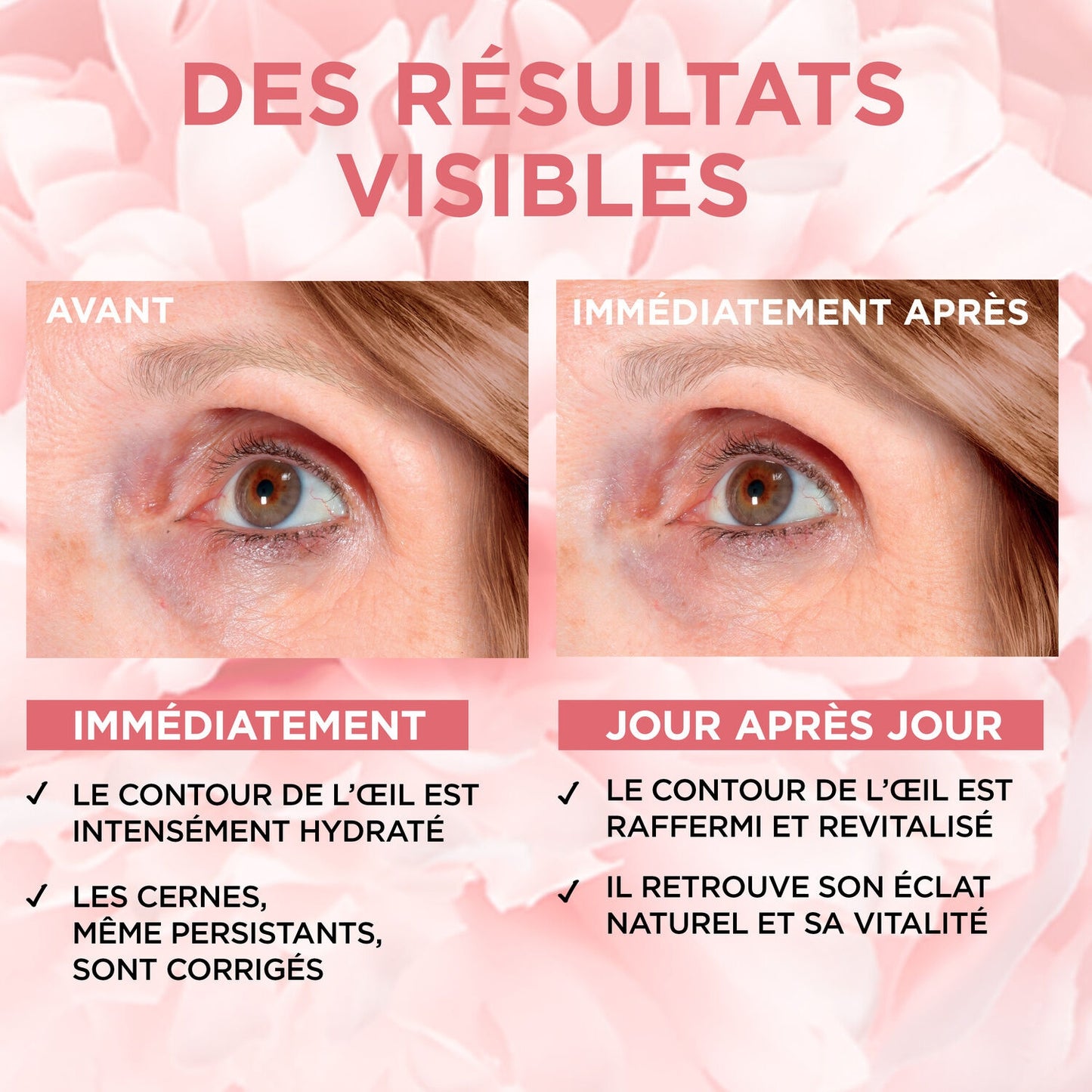 Soin des Yeux Anti-Âge Eclat Age Perfect Golden Age L'OREAL PARIS