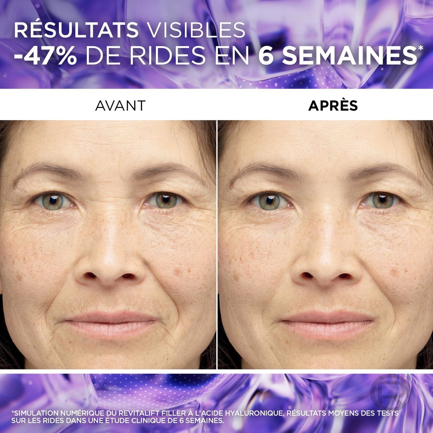 L'OREAL PARIS Pure Hyaluronic Acid Anti-Wrinkle Face Serum