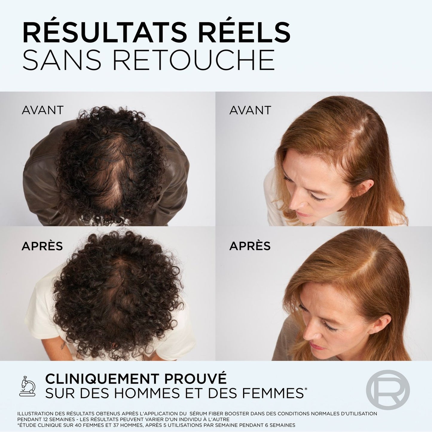 Après-Shampoing Anti-Chute Cheveux Clairsemés Aminexil-R™ Elseve L'OREAL PARIS