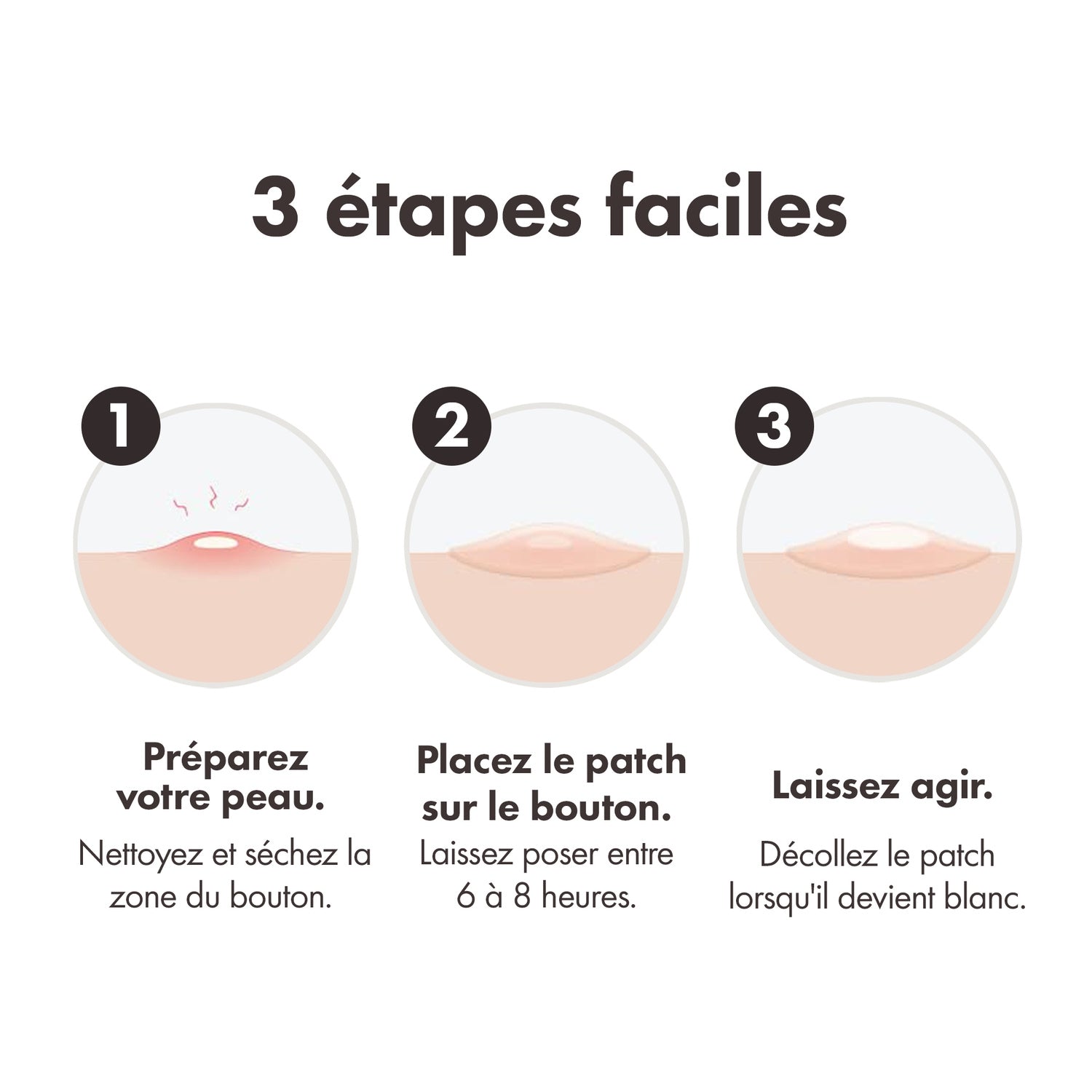 Patchs Mini Invisible Hydrocolloïde pour Boutons HERO 